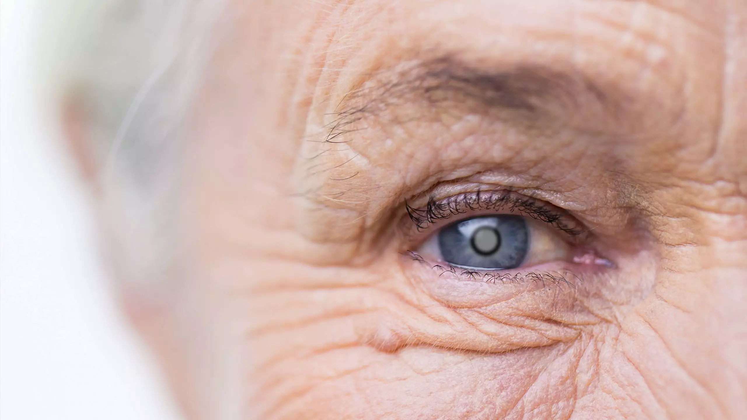 Grüner Star (Glaukom): Unbehandelt kann das Auge erblinden - OrCam